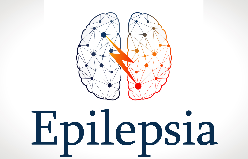 Epilepsia | Sovisalud | Medicamentos | Equipos Medicos